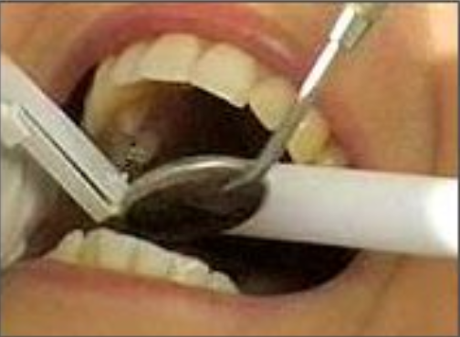 Dental Checkup: How Often?